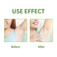 LUNOON Whole Body Deodorant Spray 100ml - Multi-Use for Underarms, Feet & More, 72-Hour Odor Control & Freshness